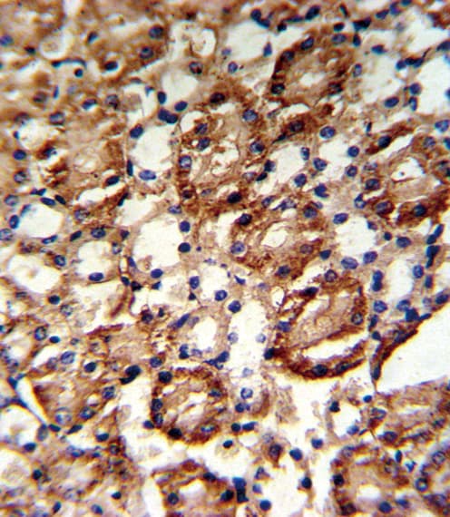 Polyclonal Rabbit anti-Human GMPS / GMP Synthase Antibody (aa602-630, IHC, WB)