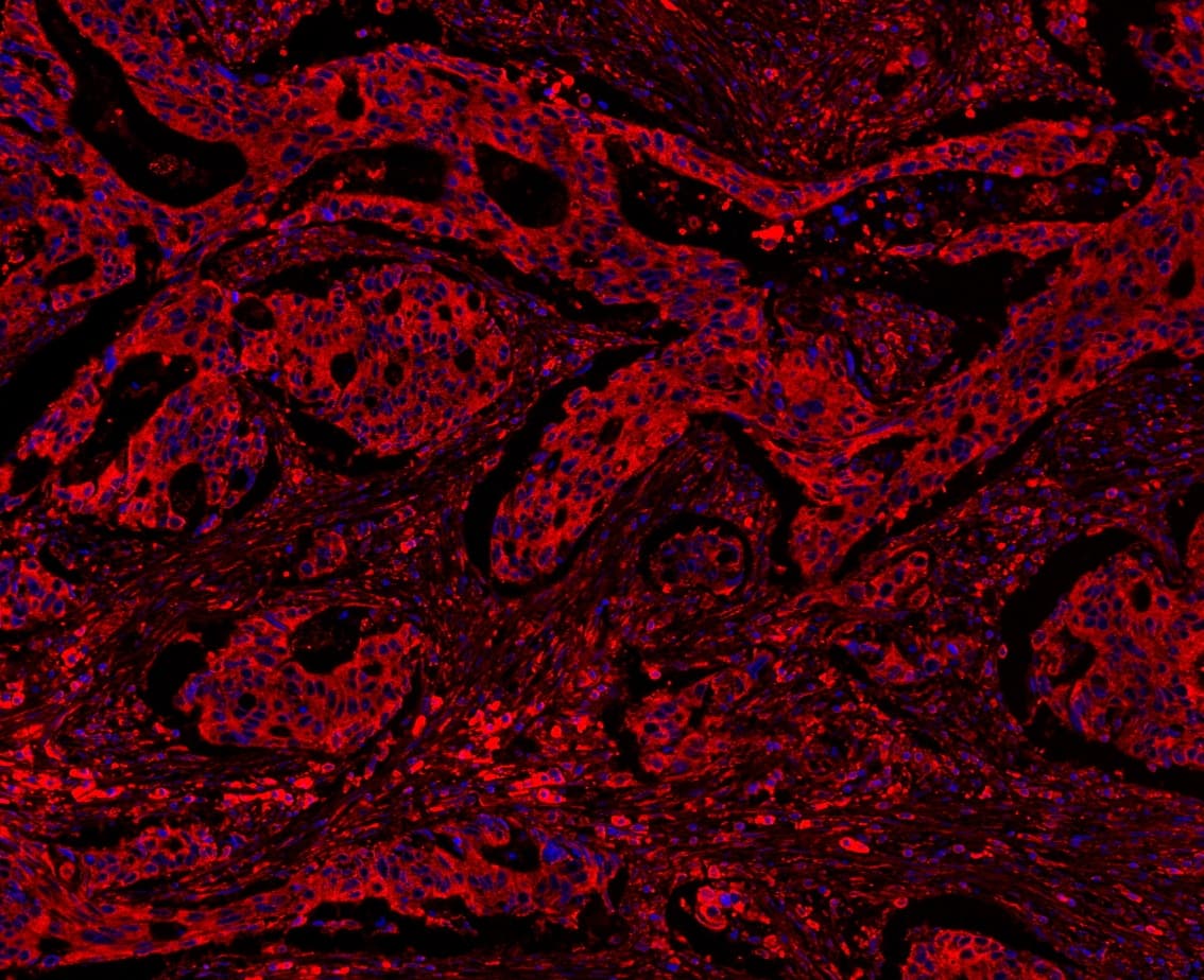 Polyclonal Rabbit anti-Human MYD88 Antibody (aa44-264, IHC, WB)