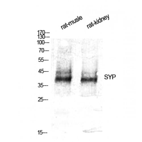 Polyclonal Rabbit anti-Human SYP / Synaptophysin Antibody (70-150 aa, Internal, IHC, WB)