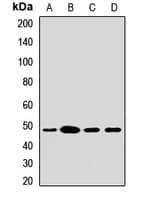 Polyclonal Rabbit anti-Human ACADL Antibody (WB)
