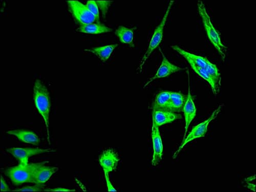 Polyclonal Rabbit anti-Human KBTBD6 Antibody (IHC, IF, WB)