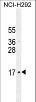 LLPH / C12orf31 Antibody (aa62-90)