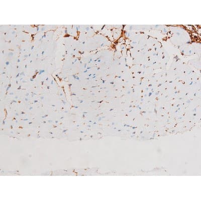 MAPK8 / JNK1 Antibody (phospho-Thr183)