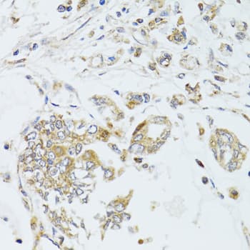 Polyclonal Rabbit anti-Human MAD2B / REV7 Antibody (IHC, WB)