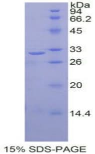 Human RELB Protein (Recombinant His-T7)