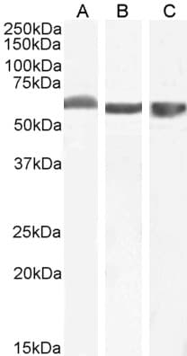 IHC-plus™ FTCD / 58K Golgi Protein Antibody (aa203-216)