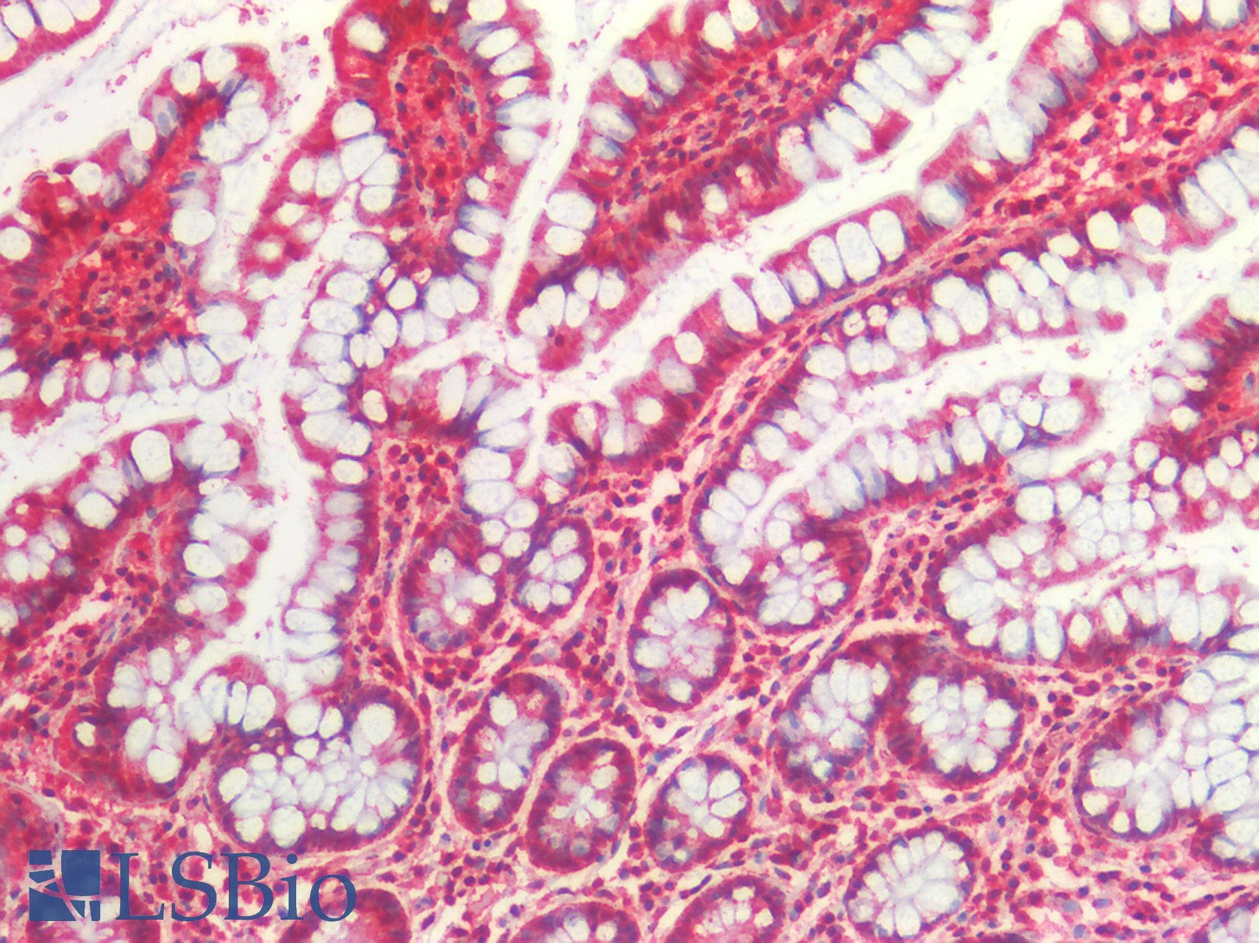 PathPlus™ Polyclonal Rabbit anti-Human HSPD1 / HSP60 Antibody (IHC, WB)