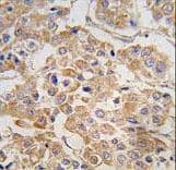 IKBKE / IKKI / IKKE Antibody (aa686-716)