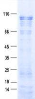 Human CHERP Protein (Recombinant His, N-Terminal)