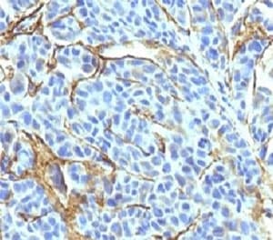 NGFR / CD271 / TNR16 Antibody (clone NTR/912)