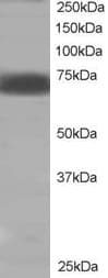 IHC-plus™ Polyclonal Goat anti-Human PTPN11 / SHP-2 / NS1 Antibody (aa584-597, IHC, IF, WB)