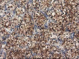 TUBB4 / Tubulin Beta 4 Antibody (clone 3C12, Carrier-free)