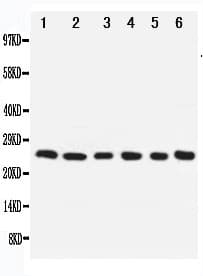 NOL3 / ARC Antibody (aa91-106)