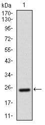 Monoclonal Mouse anti-Human ALCAM / CD166 Antibody (clone 5B3, Amino Acid: 405-524, IHC, WB)