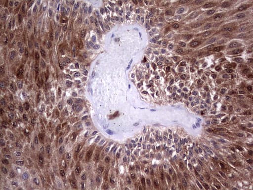 LGALS3 / Galectin 3 Antibody (clone OTI6E1)