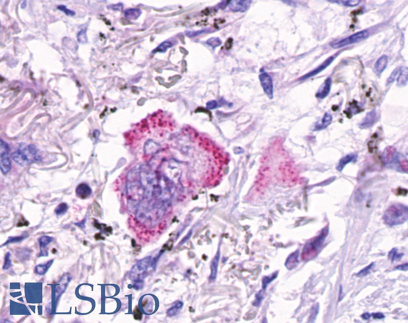 IHC-plus™ GPR48 / LGR4 Antibody (C-Terminus)