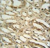 GGTLC2 Antibody (aa127-154)