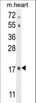 FGF16 Antibody (aa22-50)
