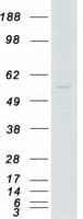 Human MATK Protein (Recombinant Myc-DDK (Flag))