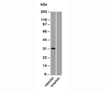 UPK3A / UPK3 / Uroplakin III Antibody (aa260-279)