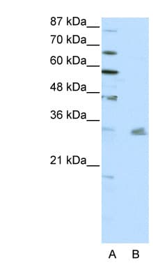 PITX3 Antibody (N-Terminus, HRP)