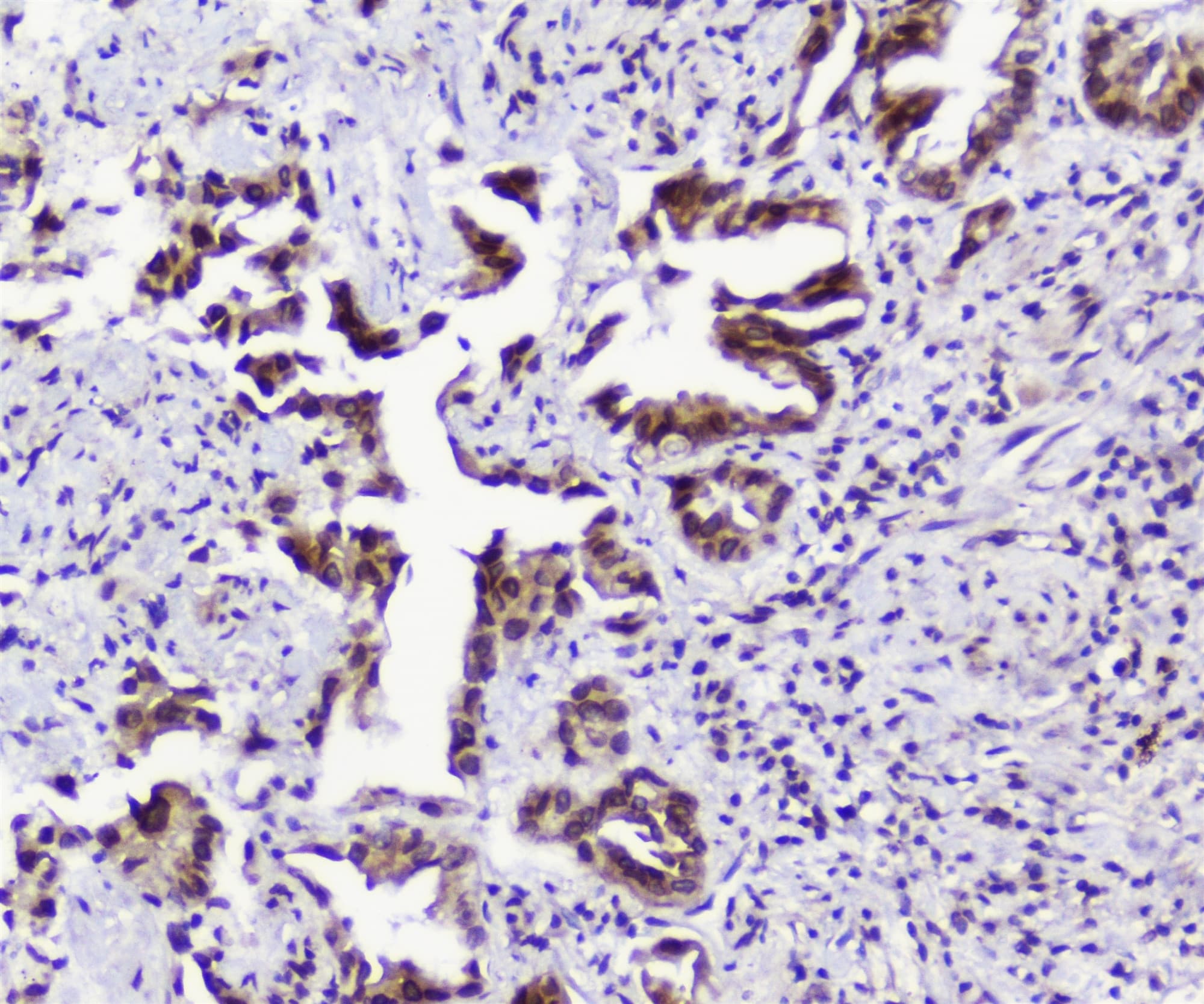 TPR Antibody