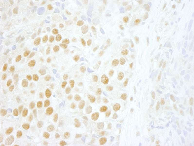 ZMYM2 / RAMP Antibody (aa1327-1377)