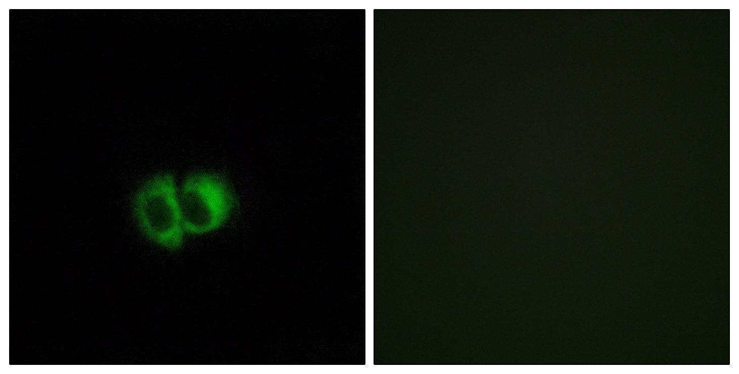 OXER1 Antibody