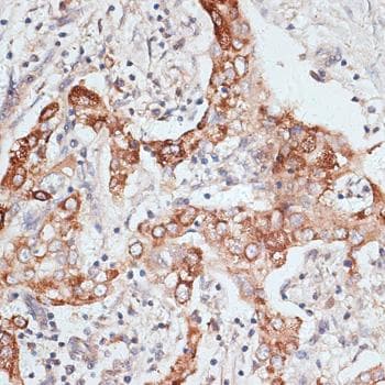 PIGR Antibody