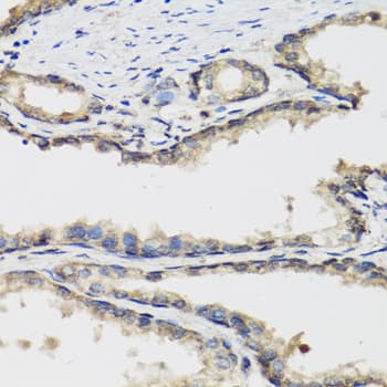 IHC-plus™ LP-PLA2 / PLA2G7 Antibody