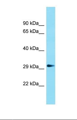 GDPD1 Antibody (N-Terminus)