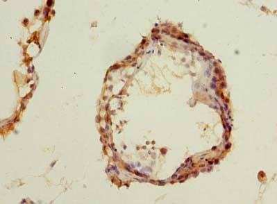 Polyclonal Rabbit anti-Human MCM9 Antibody (IHC, WB)
