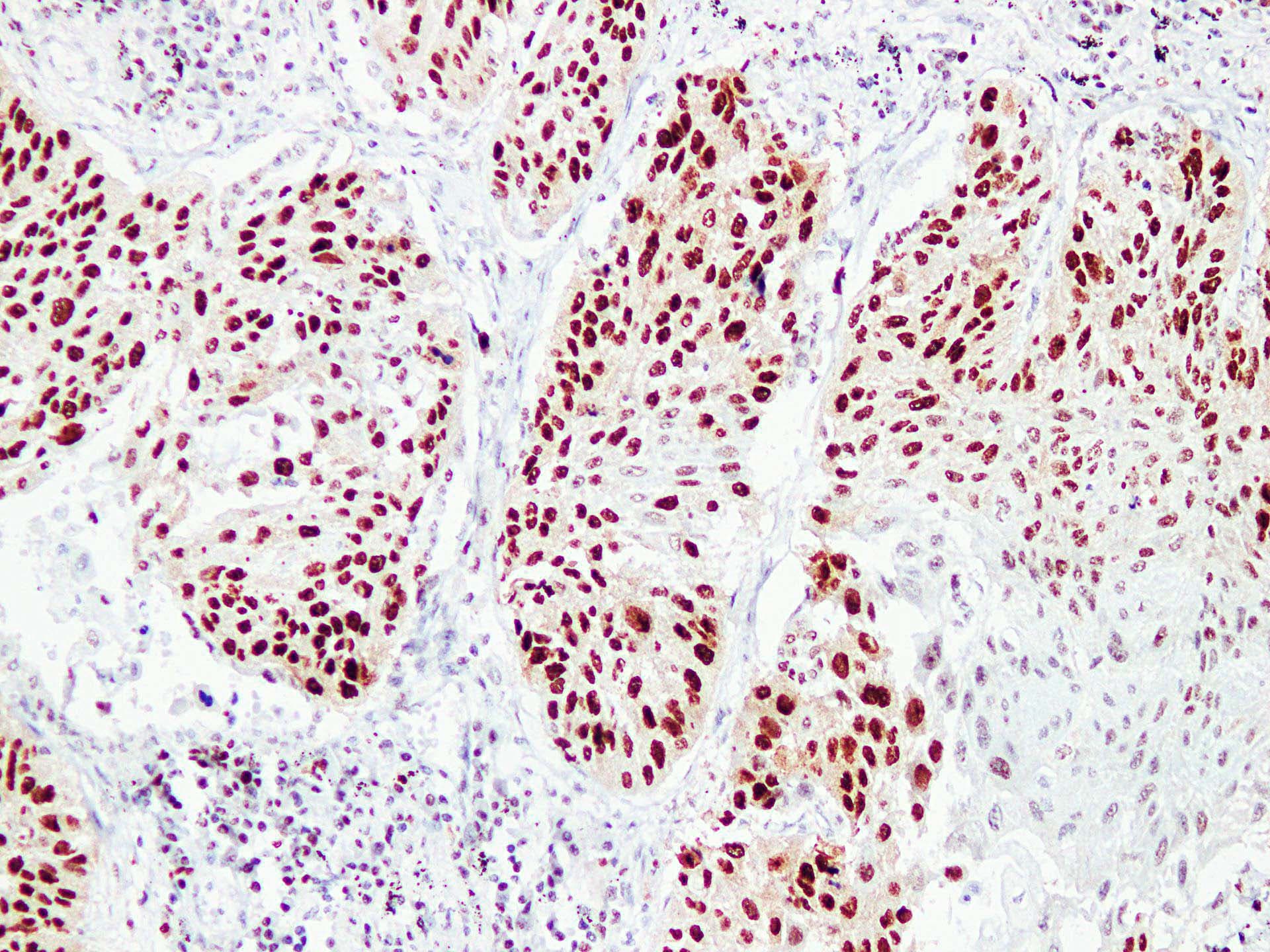 IHC-plus™ PCNA Antibody (clone ABT-PCNA)