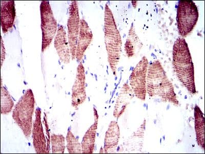 RPS6KB1 / P70S6K / S6K Antibody (clone 5G9)