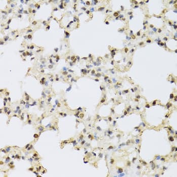 Polyclonal Rabbit anti-Human MAPK3 / ERK1 Antibody (IHC, IF, WB)