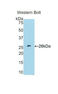 CRP / C-Reactive Protein Antibody (aa21-225)