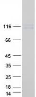 Human LY9 / CD229 Protein (Recombinant Myc-DDK (Flag))