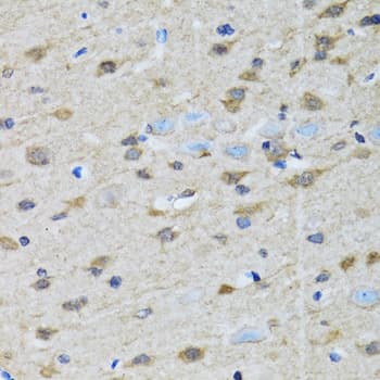 GOLM1 / GP73 / GOLPH2 Antibody