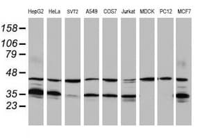 HMOX2 / Heme Oxygenase 2 Antibody (clone OTI4H8)