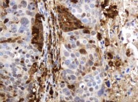 TP / Thymidine Phosphorylase Antibody (aa311-482, clone 7A6, Carrier-free)