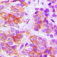 Polyclonal Rabbit anti-Human FZD5 / Frizzled 5 Antibody (C-Terminus, IHC, WB)