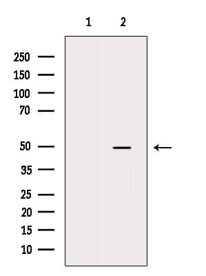 Polyclonal Rabbit anti-Human ACADL Antibody (WB)