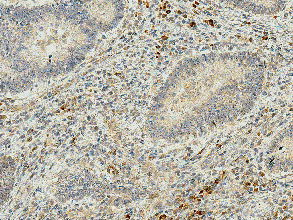 IRGM / LRG-47 Antibody