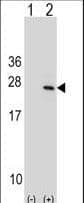 Polyclonal Rabbit anti-Human PTP4A1 / PRL-1 Antibody (aa140-168, WB)