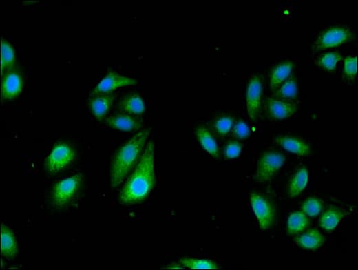 TCTN3 Antibody