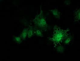 PRKAR1B Antibody (clone OTI2A3)