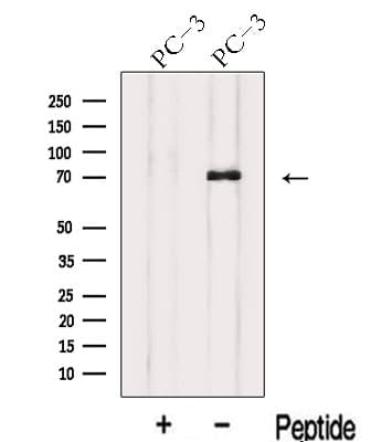 Polyclonal Rabbit anti-Human IL17RE Antibody (WB)