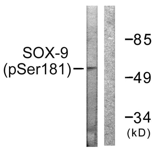 SOX9 Antibody (phospho-Ser181)