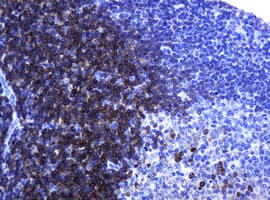 CD79A / CD79 Alpha Antibody (clone OTI5E2, Carrier-free)