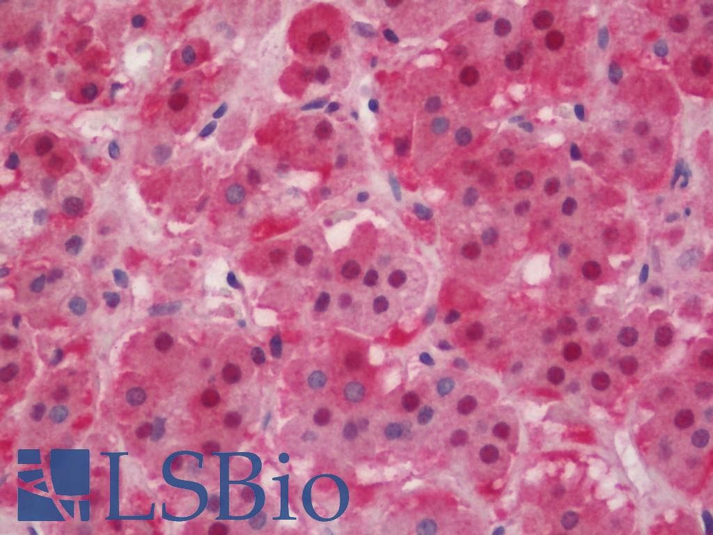 PathPlus™ IDH1 / IDH Antibody (aa116-143)